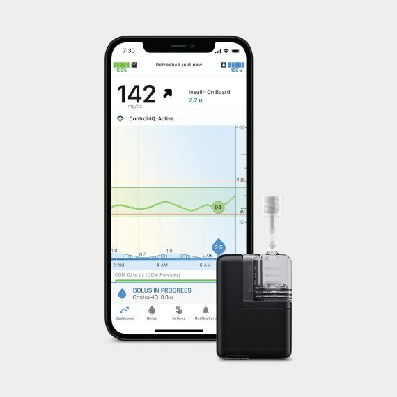 Buy Tandem Mobi Insulin Pump | Dexcom G7 & G6 Compatible