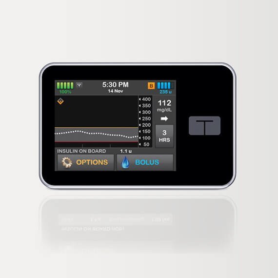 T: Slim X2 Control-IQ Insulin Pump: Smart Diabetes Management